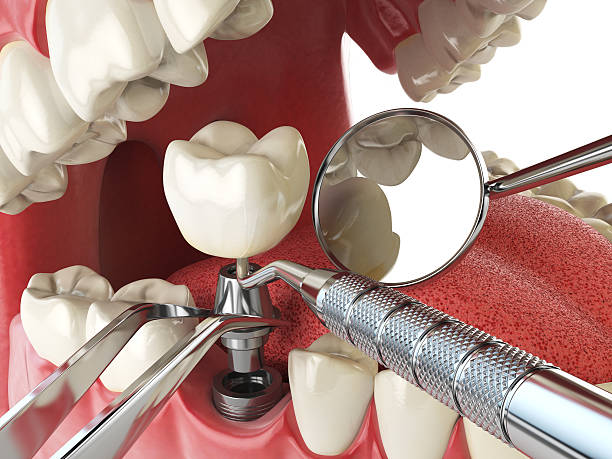 Best Broken or Cracked Tooth Emergency Dentist in Hawkinsville, GA