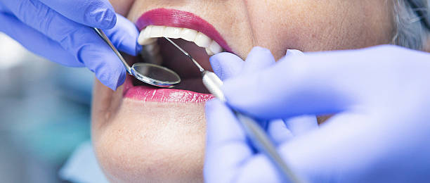 Best Emergency Root Canal Treatment in Hawkinsville, GA